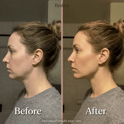The Byalyra Sculpt Gua Sha™
